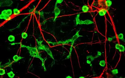 Microglia como terapia: a nova esperança contra o Alzheimer e outras doenças do cérebro